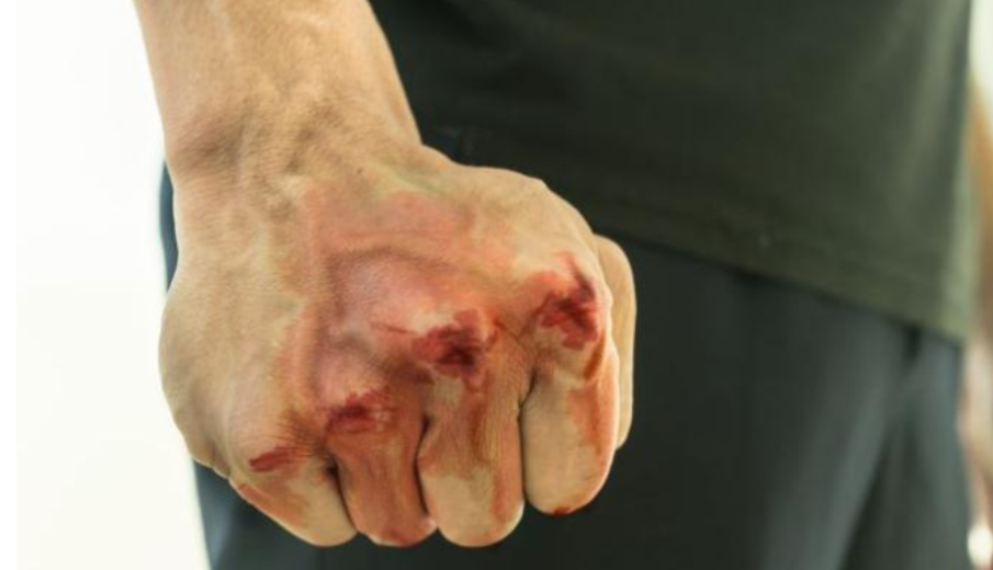 Задържаха мъж, нападнал с удари 19-годишния си брат в Шумен