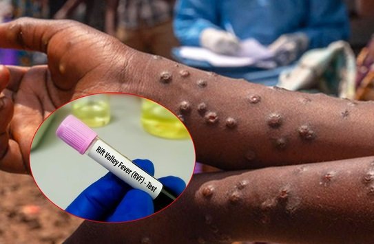 Две държави пламнаха от вирус, смятан за биологично оръжие