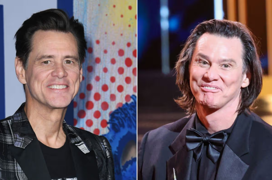 Известен пластичен хирург защити Джим Кери от злобните критики за външния му вид