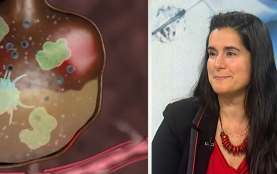 Рентгенологът проф. Златарева: COVID-19 не нанася трайни увреждания във времето