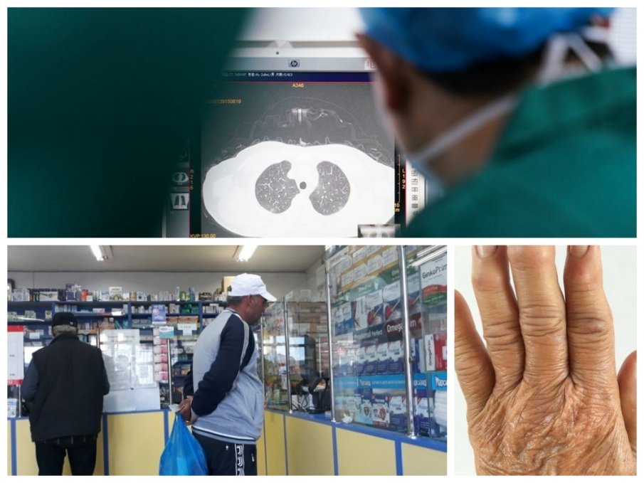 НОВ ПОДХОД: Медикаменти срещу артрит спасяват от COVID-19