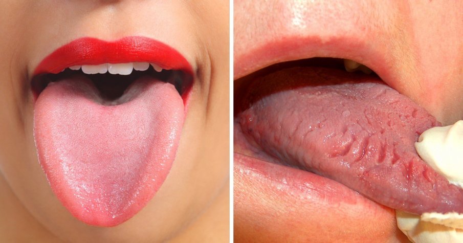 Зачервяването на езика говори за тежки болести