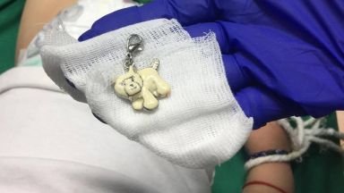 Спасиха дете, глътнало ключодържател с царевични пръчици