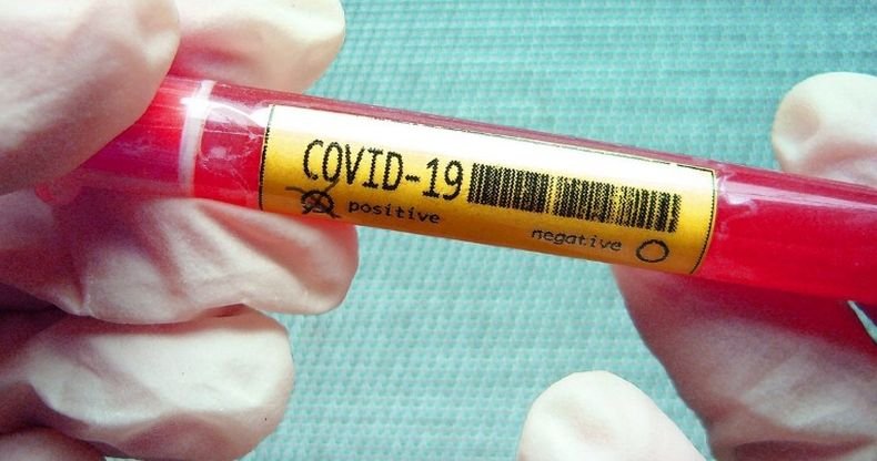 20 548 новозаразени с коронавируса в Мексико за денонощие