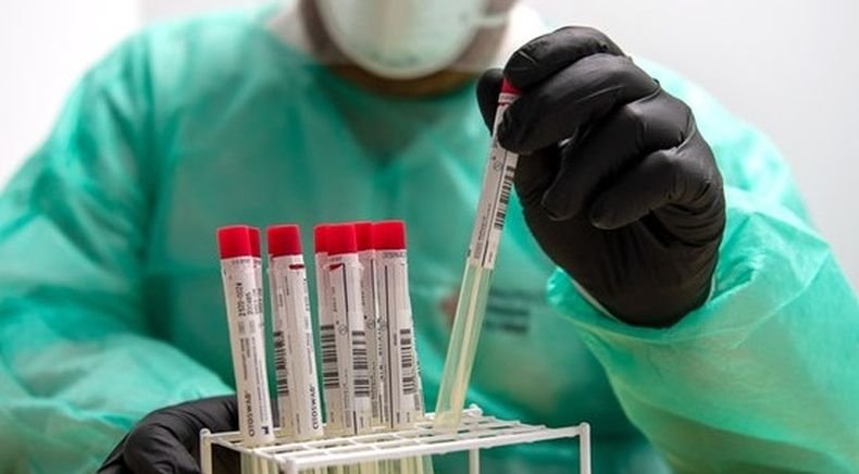 82 нови случая на заразяване с коронавируса в Китай