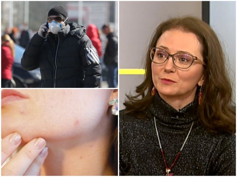 Топ дерматологът доц. Весела Райкова с важни новини - какви поражения причинява COVID върху кожата, как да се справим с обривите от маските и дезинфектантите