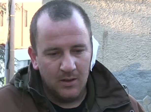 Бракониери нападнаха горски, единият е с разкъсано ухо