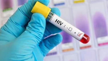 ПРОБИВ! Две обещаващи ваксини срещу СПИН са пред клинични изпитания