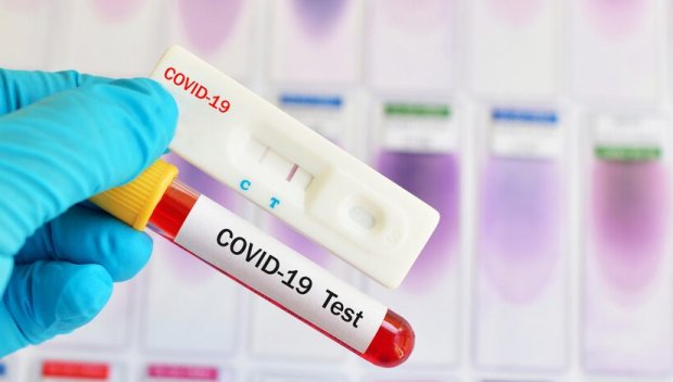НАЙ-НОВИ ДАННИ: 10 са новите случаи на COVID-19