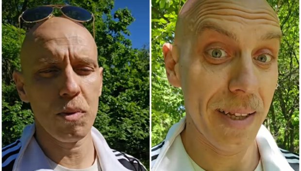 ШОКИРАЩО ПРИЗНАНИЕ! Един от най-нашумелите комици у нас се бори с рака - станал е неузнаваем заради химиотерапията
