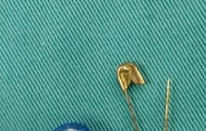 ужасяващо шестмесечно бебе погълна безопасна игла спасиха