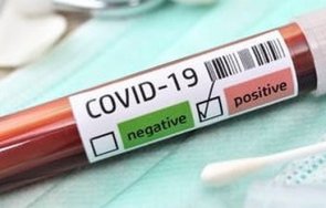 100 новозаразени коронавируса денонощие гърция