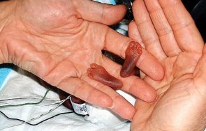 зловещо фармацевтичната мафия италия предизвиквала аборти използва плода тестване covid ваксини