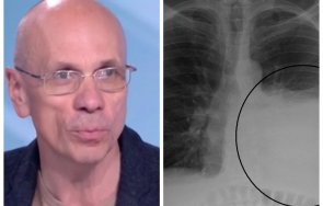 топ кардиолог обясни разберем увреден необратимо белият дроб covid