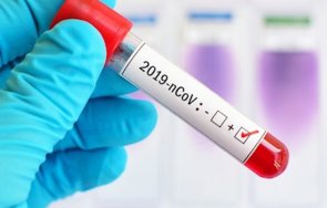 заразените коронавируса мексико достигнаха 524 654 души