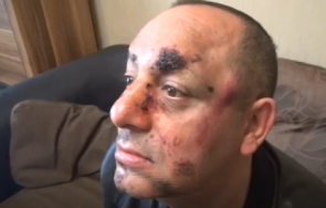 брутално тираджии пребиха ограбиха мъж видин карал