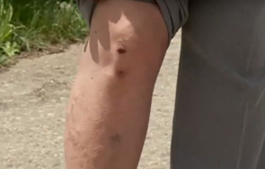 пес нападна наръфа кръв възрастна жена