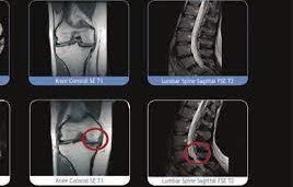 нов мобилен рентген помага лекарите умбал бургас
