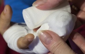 работник русе остана без пръст злополука