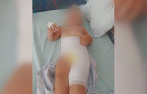 двегодишно момиченце тежки изгаряния детската градина заради дезинфектант