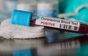 Само 6 са новите случаи на коронавирусна инфекция за изминалото