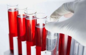 Кръвната група съдържа информация за еритроцитите червените кръвни телца на