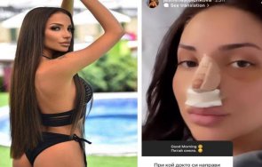 клъцни срежи мис силикон си оперира нослето