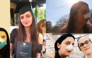 куче отхапа носа на фотографка кюстендилско събират 150 000 лева за операция