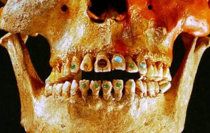 маите развили собствена стоматология скъпоценни камъни