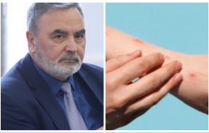 потвърдено трети случай маймунска шарка нас