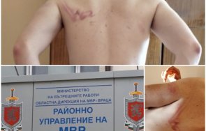 Полицейското насилие над 22-годишен мъж в Козлодуй: Прокуратурата започва проверка