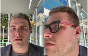 побой кандидат народен представител бсп късните часове девети септември