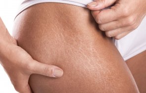 хитри начина премахнем стриите