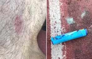 уцелиха бомбичка физиотерапевта цска