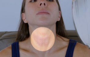 имат жените адамова ябълка