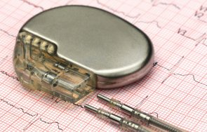 втора мбал софия вече поставят пейсмейкъри нарушения сърдечния ритъм