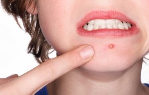 каква разликата цирей пъпка