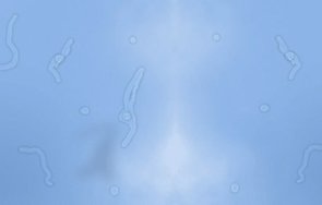 представляват червейчетата виждате плуват очите