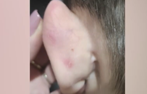 майка твърди детето жертва системен тормоз детска градина