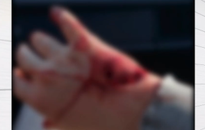 питбул нахапа мъж кучето пловдив