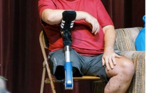 живот фронта украинец сам ампутира крака руска атака