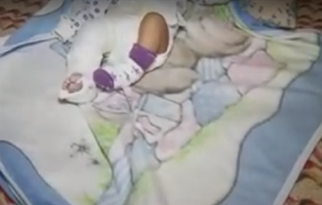 приеха болница бебе жълтеница изписаха счупен крак