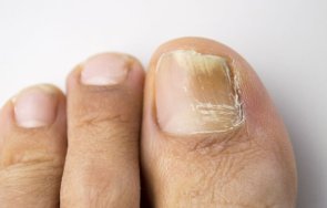 пет проблема ноктите краката погрижите тях
