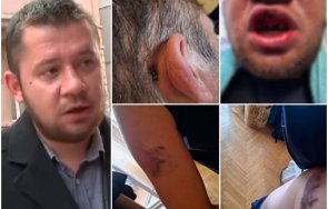 млад мъж твърди нападнат без вина полицаи нощта протестите софия