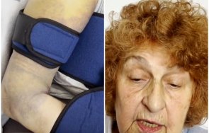 проговори жената влачена трамвай навръх нова година