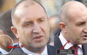 пик ретро лечител изцери румен радев снимки