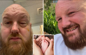 разядено киселина мъж изгуби зрението едното око докато спасява сина