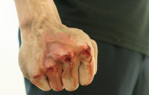 задържаха мъж нападнал удари годишния брат шумен