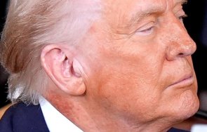 тръмп превантивно лечение заради обрив врата