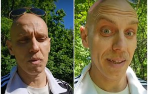 шокиращо признание един нашумелите комици нас бори рака